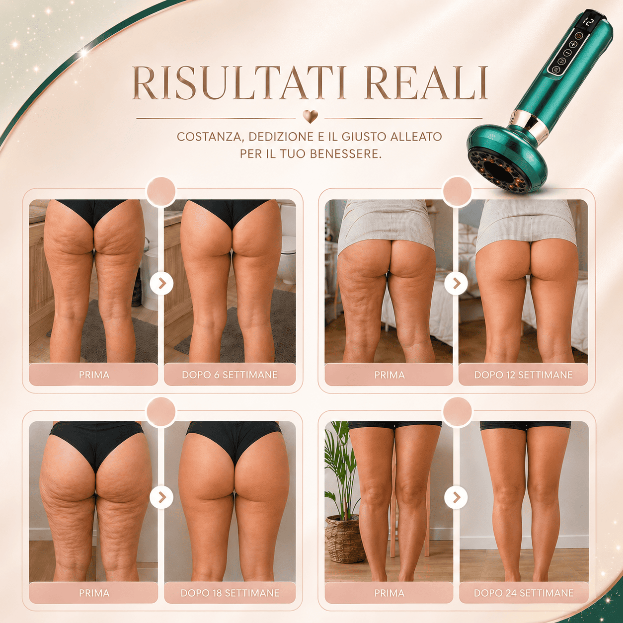 CupSage™ - Dispositivo a coppettazione
