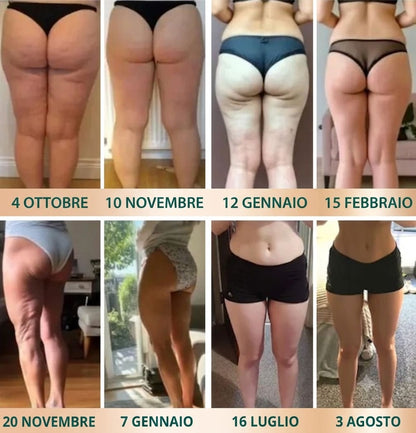 CupSage™ – Massaggiatore Drenante Corpo